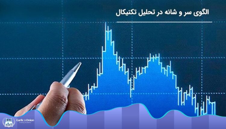 الگو سر و شانه